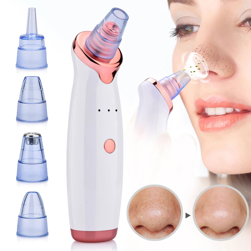 GlowLilly Electric Vacuum Blackhead Remover?